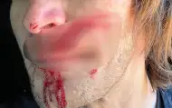 La bêtise de certains qui a failli coûter à vie a Taddy Blasuziack La bêtise de certains qui a failli coûter à vie a Taddy Blasuziack