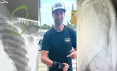 EnduroGP : le point sur l'infirmerie EnduroGP : le point sur l'infirmerie