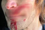 La bêtise de certains qui a failli coûter à vie a Taddy Blasuziack La bêtise de certains qui a failli coûter à vie a Taddy Blasuziack
